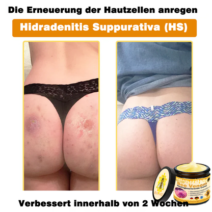 Genieße 30 % Rabatt beim Hinzufügen des zweiten Artikels 🧡（upsell） (zpf)