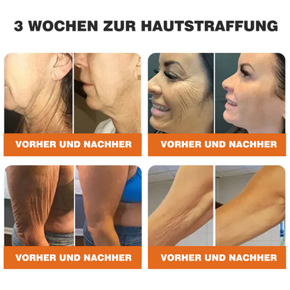 Genieße 30 % Rabatt beim Hinzufügen des zweiten Artikels 🧡（upsell） (zpf)